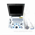 Female hepatitis ultrasound diagnostic instrument